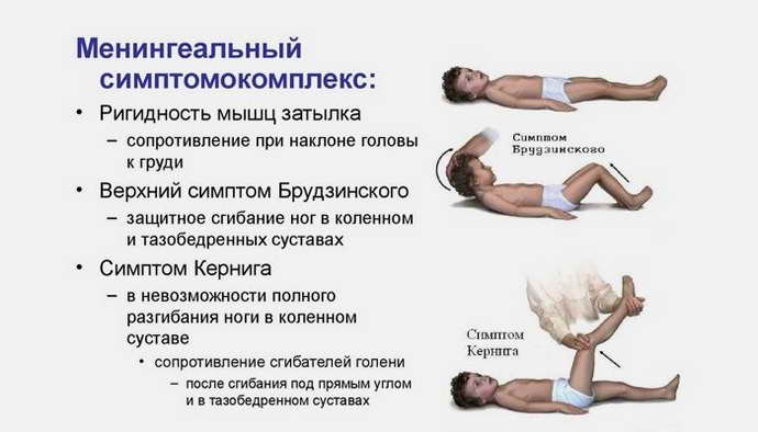 Положительная реакция при проверке симптома Пулатова при менингите