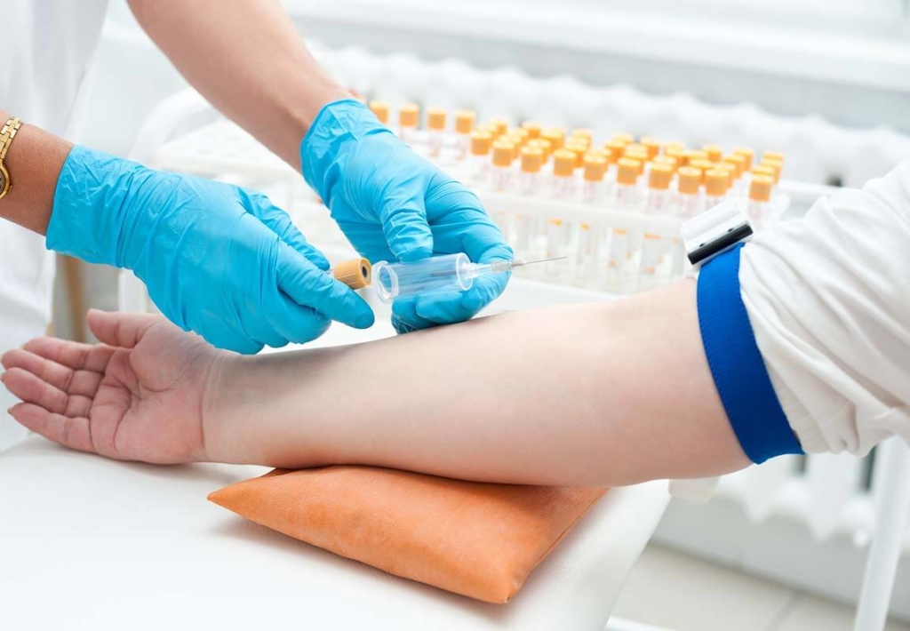 Что определяет анализ крови на ХГЧ и как его сдавать?