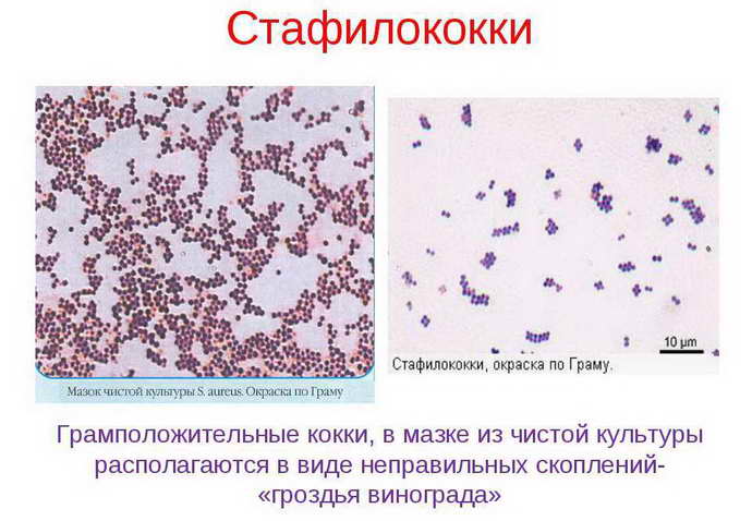 бактериальный менингит причины