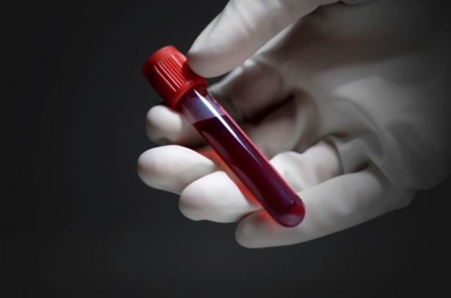Метод иммуноферментного исследования крови. Особенности сдачи анализа, его стоимость