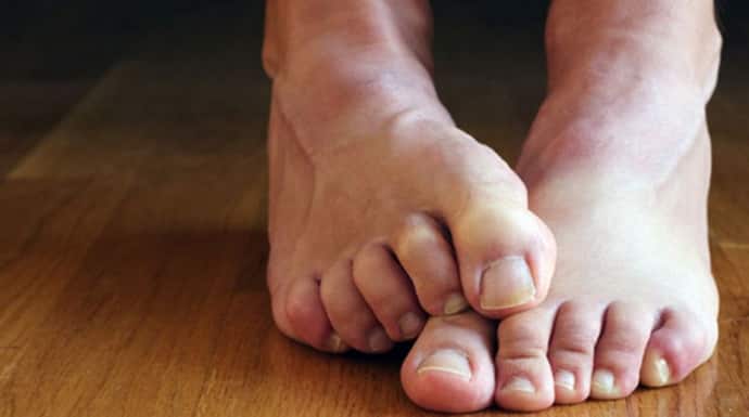 Почему болят ноги при корешковом синдроме