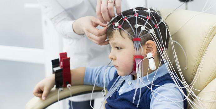 Проведение ЭЭГ головного мозга ребенку, показания и противопоказания к процедуре