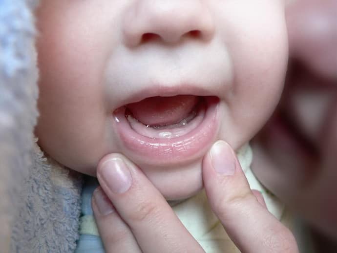 При прорезывании зубов ребенок дергается во сне