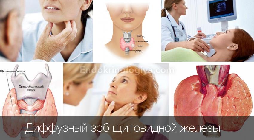 диагностика заболевания щитовидной железы