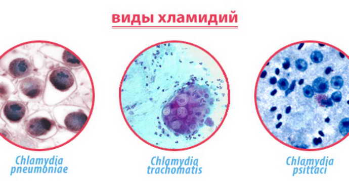 бактериальный менингит вирус