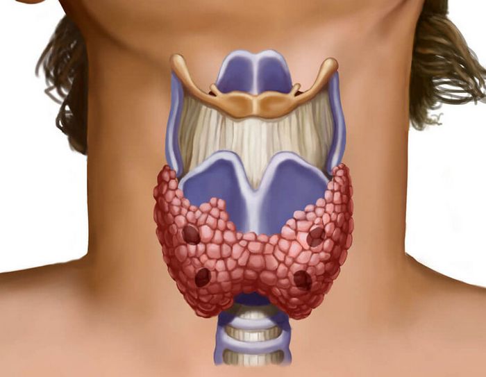 Признаки АИТа щитовидной железы
