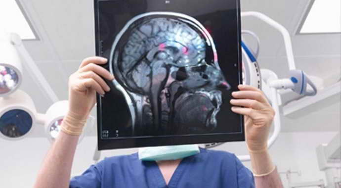 В чем преимущества МРТ головы