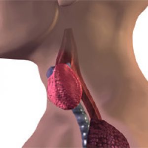 ДТЗ щитовидной железы что это такое 