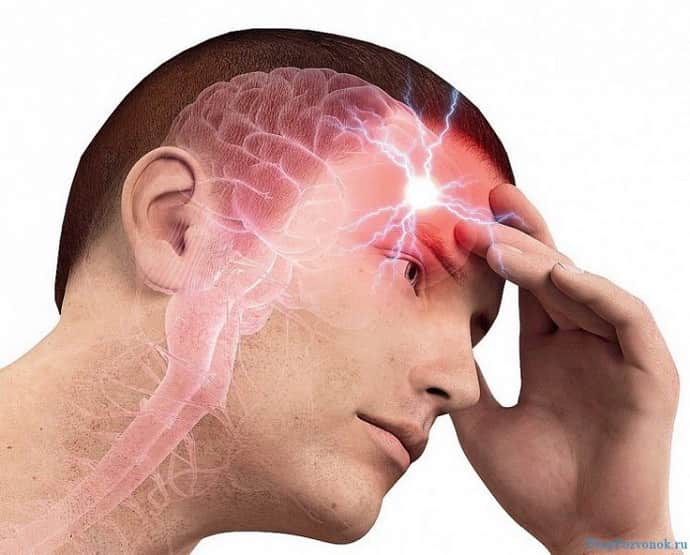 Что делать если возникла головная боль при всд