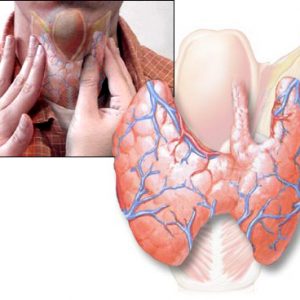 Болезни щитовидки