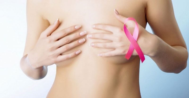 Гормонозависимый рак молочной железы