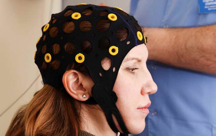 Внутричерепная регистрация ЭЭГ при эпилепсии