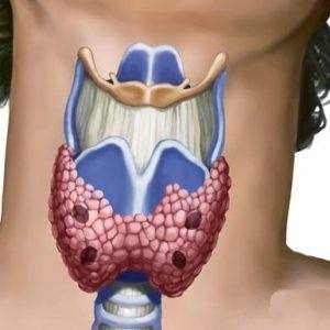 эутиреоз щитовидной железы