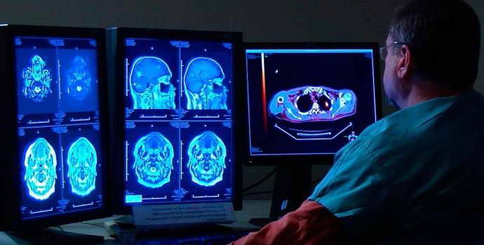 Лакунарная киста головного мозга: причины, симптомы, лечение