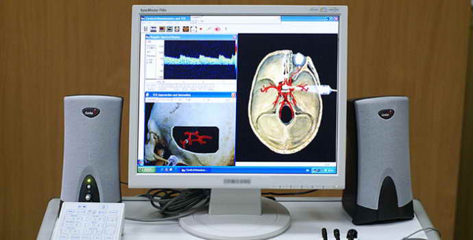Дуплексное сканирование сосудов головного мозга: инновационный метод диагностики