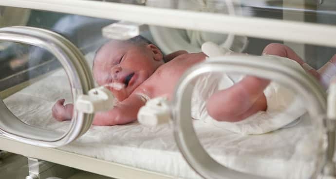 Болезнь у новорожденных, левосторонний гемипарез
