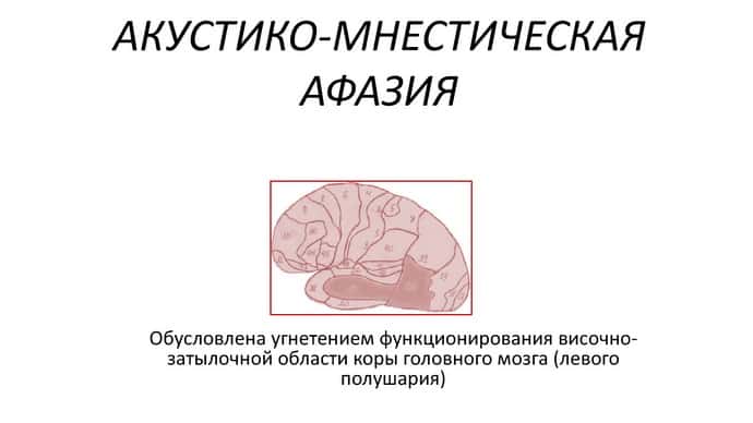 Как возникает акустико мнестическая афазия