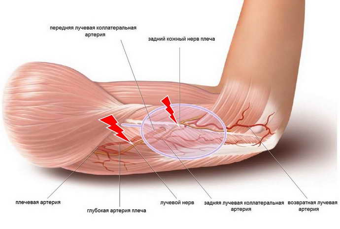 защемление нерва в плечевом суставе причины