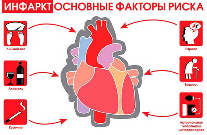 Симптомы инфаркта