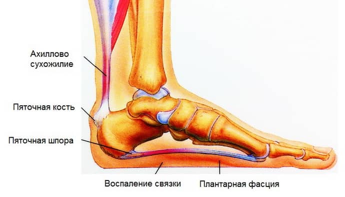 Причины, по которым немеет пятка левой ноги