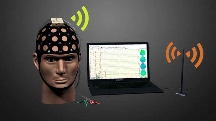 ЭЭГ головного мозга используют при мониторном наблюдении