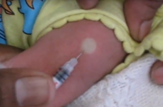 Вакцинация младенца прививкой БЦЖ