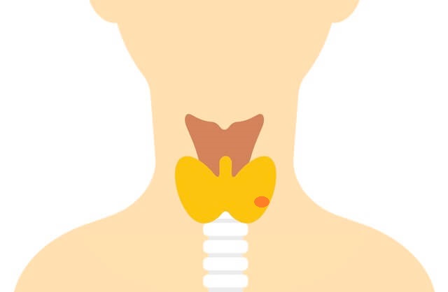анэхогенные включения в щитовидной железе