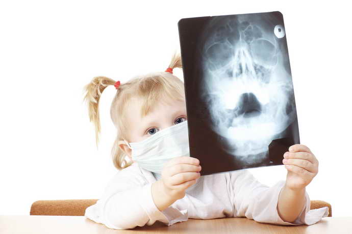 Рентген мозга у детей