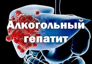 Алкогольный гепатит. Гепатит от алкоголя симптомы. Алкогольный гепатит клинические рекомендации. Алкогольный гепатит симптомы у женщин. Алкогольный гепатит симптомы и лечение у мужчин.