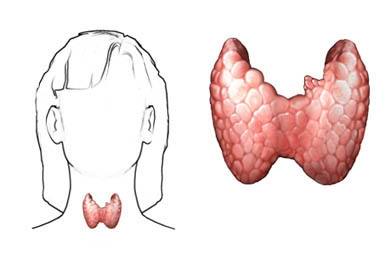 Тиреоидит щитовидной железы