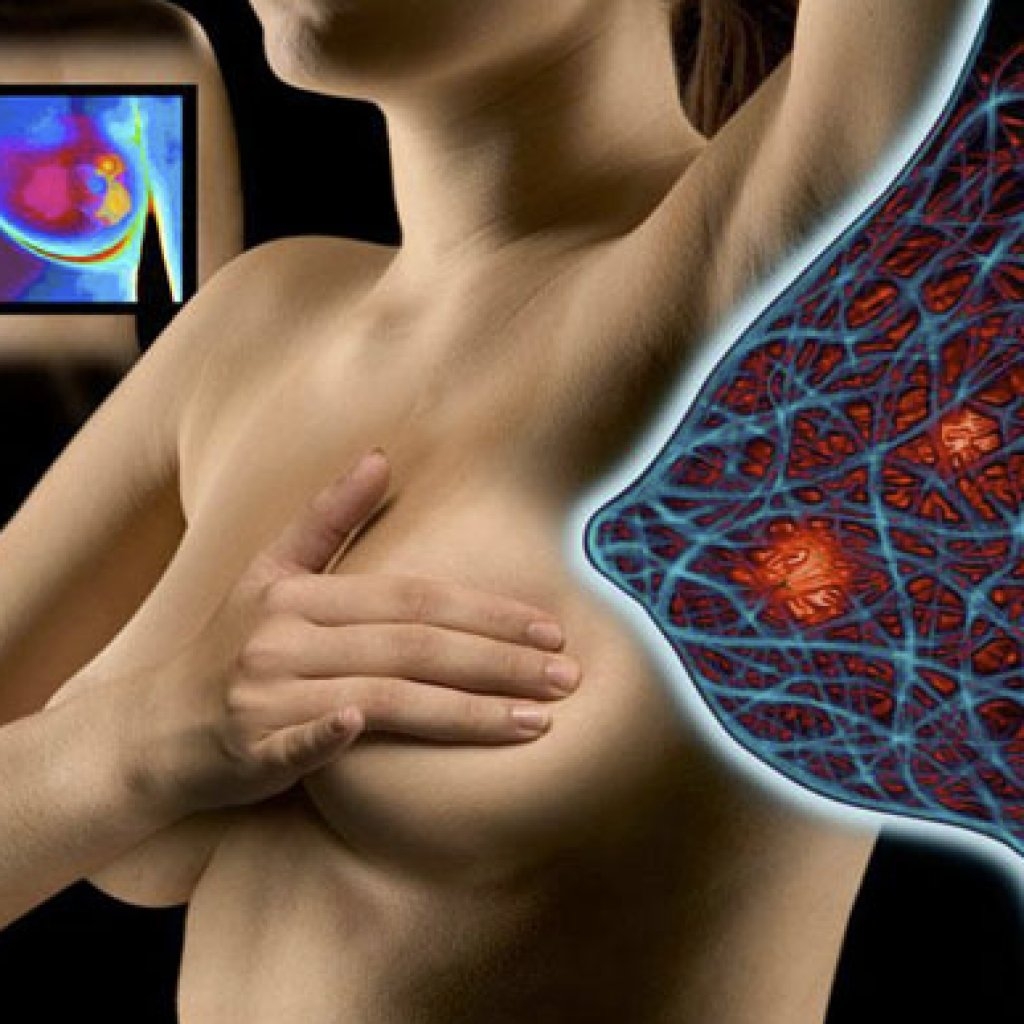 уплотнение в груди у женщин причины фото 101