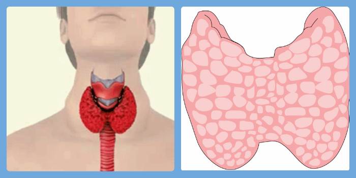 Признаки заболевания щитовидной железы