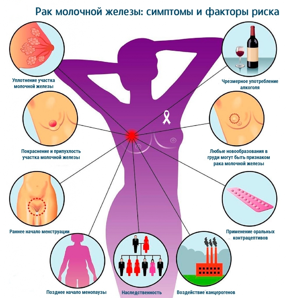 симптомы заболевания груди у женщин фото 27