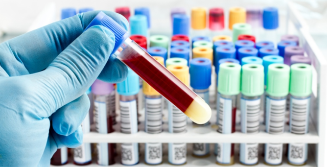 Когда нужно сдавать анализ крови на раковые клетки? Где это делать и какова цена?