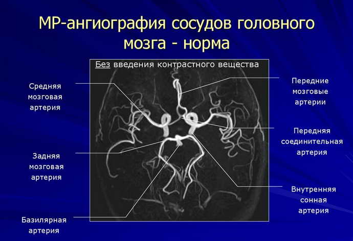 Принято выделять следующие формы менингиальных опухолей мозга