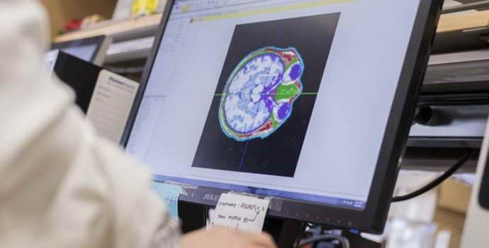 Ирритация коры головного мозга ведет к серьезным нарушениям во всем организме