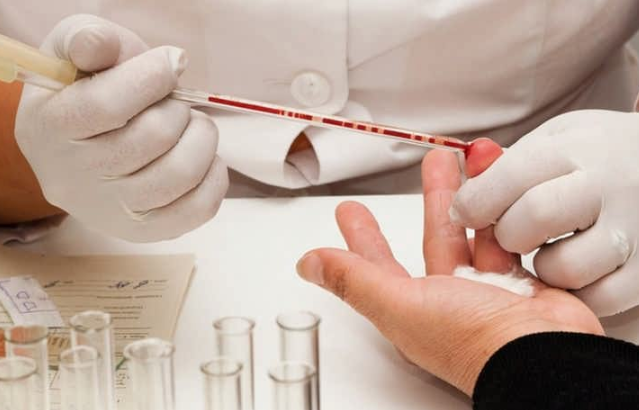 Общий анализ крови при ВИЧ показатели, указывающие на вирус