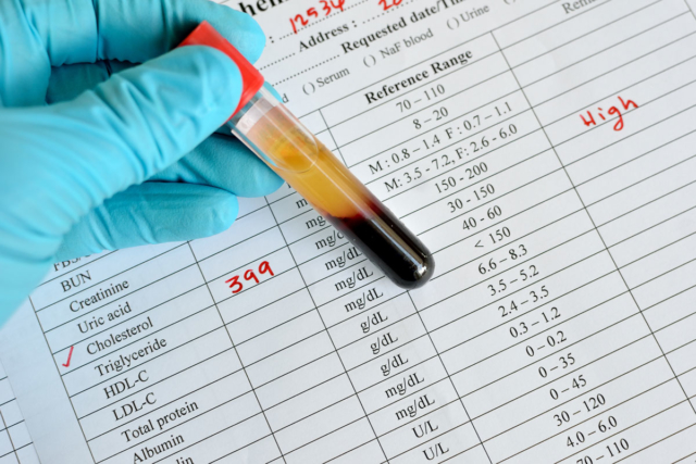 Зачем делают биохимический анализ крови и как его расшифровать?