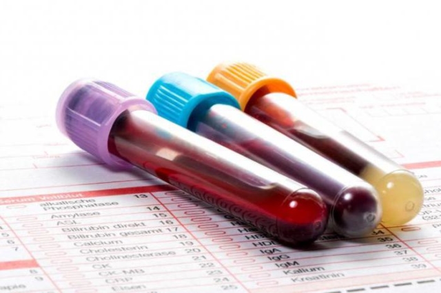 Показатель СРБ в анализе крови: что это значит?