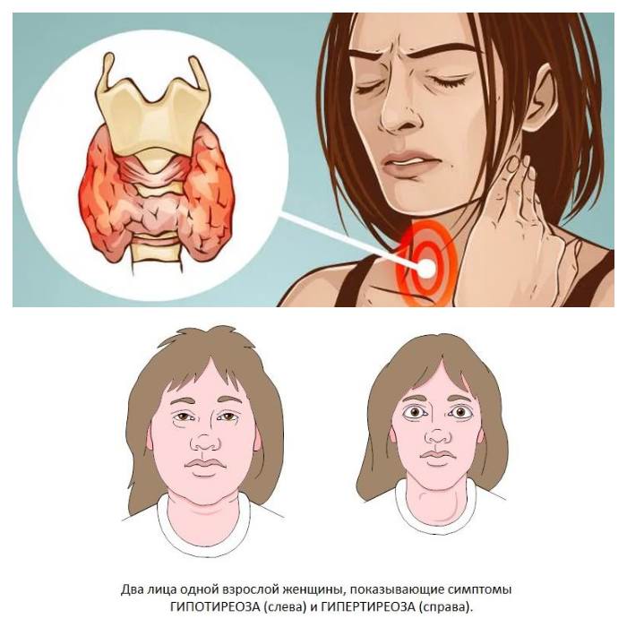 Нарушение функции щитовидной железы симптомы