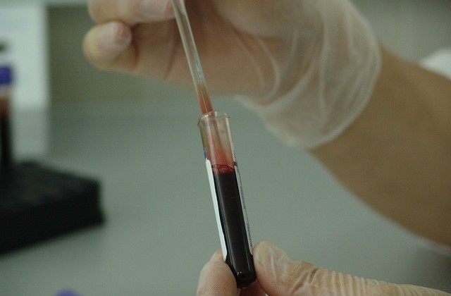 Исследование анализа крови в лаборатории