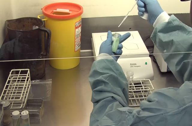 Анализа мокроты на туберкулёз в лаборатории