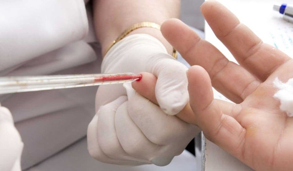 Почему повышено количество лимфоцитов в крови у взрослого мужчины? Можно ли привести в норму?