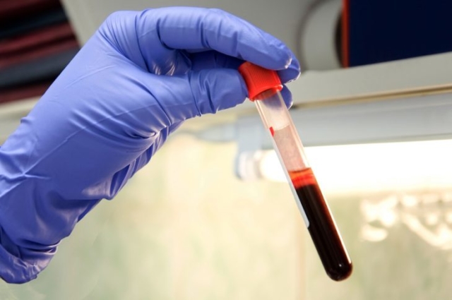 Для чего необходим анализ крови на гемостаз и так ли это важно?