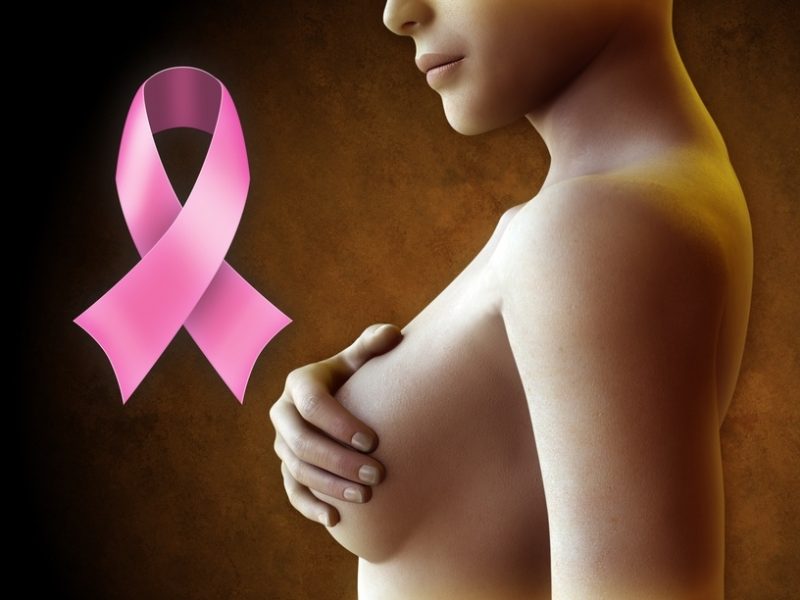 Рак молочной железы 4 стадия