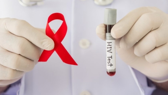 Что такое ложноположительный анализ на ВИЧ? Диагностика и причины результата
