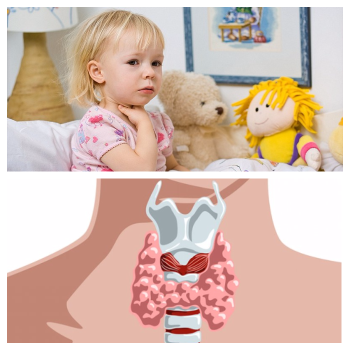  узлы в щитовидной железе у детей