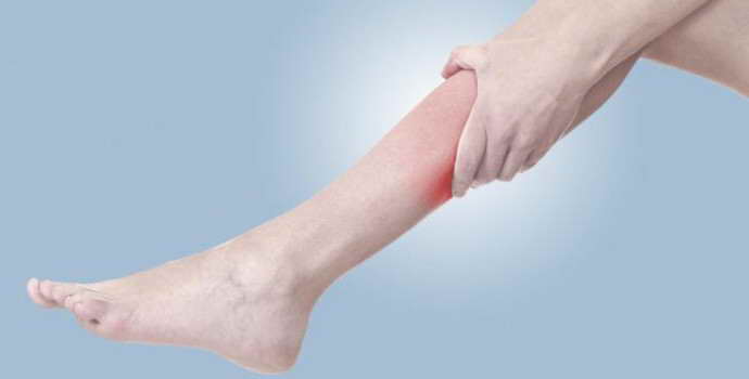 Защемление нерва в ноге: причины, сопутствующие симптомы, лечение