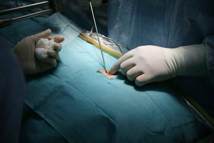 секвестрированная грыжа операция