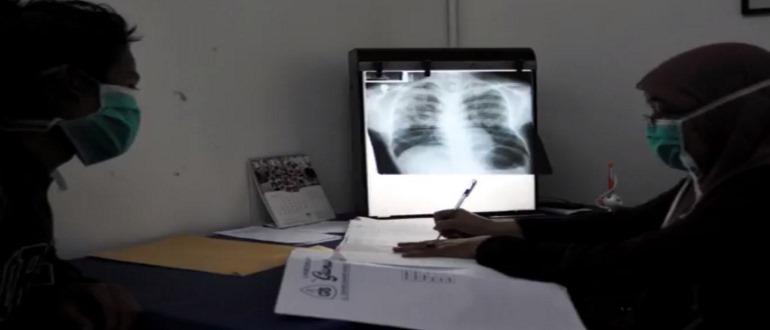 Туберкулёз легких на рентгене